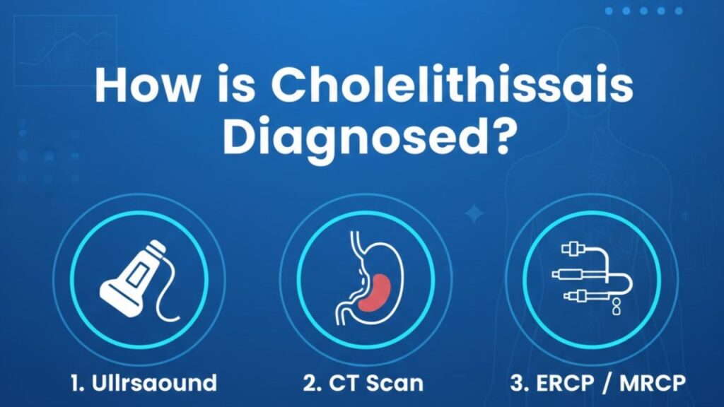 How Is Cholerhiasis Diagnosed?
